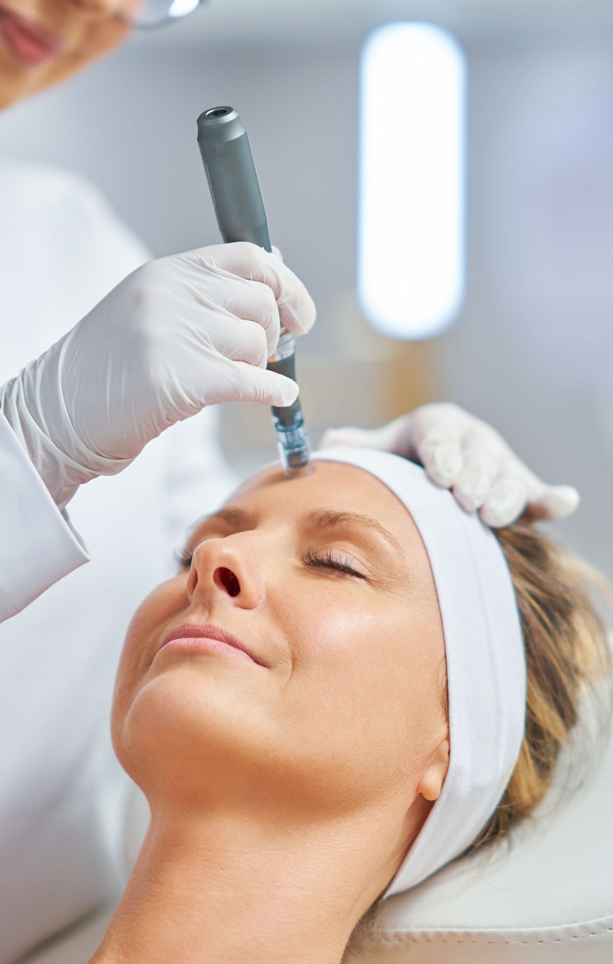 pic-microneedling- vibrant